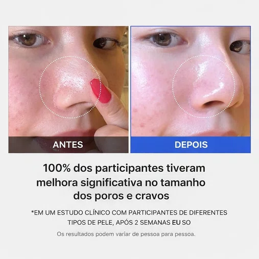 Medicube Zero Pore Pad - 155g - 70 pads