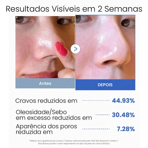 Toner Pads Zero Pore Pad com 70 unidades | Medicube