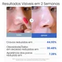 Toner Pads Zero Pore Pad com 70 unidades | Medicube